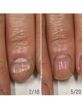 ネイルズ アヴァンティ(Nails Avanti)/自爪育成ネイルケア