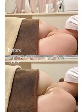 プリマベラ 大阪梅田(primabella)/横から見ても高さのあるバスト