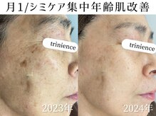 トリニエンス 南流山店の雰囲気（月1回集中シミケア/年齢肌も同時にケア！コンディション爆上がり）