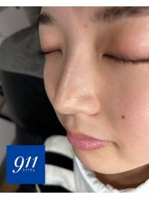 水素ジム911 心斎橋/韓国肌管理*ララピール¥4,800