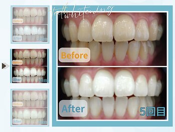 グロウ グロウ(grow.glow)/