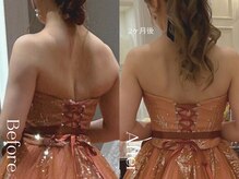 ユーフォリア グロウ(euphoria glow)/｛ &nbsp;ラフォス痩身90分 &nbsp;10回 &nbsp;｝