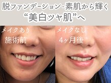 アルカンシエル(arcenciel)の雰囲気（ファンデに頼らず輝く素肌へ。内側から潤う透明美肌。）