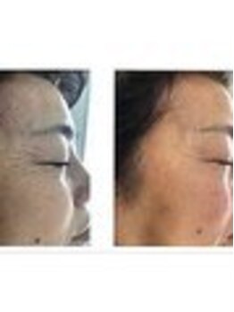 ハイナ 恵比寿店(Hi-Na)/恵比寿/フェイシャル/ブライダル