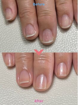 ワイ(Y)/ネイルケア/自爪育成