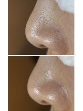 フラリス(fraris)/