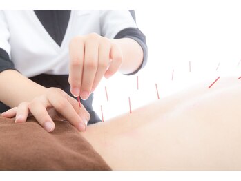 アイメディカル鍼灸整骨院の写真/慢性的なこりや急な痛みに鍼灸施術で全身の巡りを整えて、不調の原因にアプローチ。
