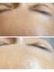 ミイル(Miiru)の写真/【初回限定キャンペーン実施中】フェイシャルWaxで、自信の持てる肌へ