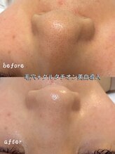 ナチュラ ソース(NatureSouce)/美白、透明感、毛穴、黒ずみ