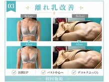 ネイト ワックス(Neit Wax)/離れ乳を自然改善◎