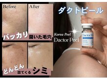 サロンフィーユ(Fille)の雰囲気（諦めかけてた、パッカリ開き毛穴・たるみ毛穴に効果抜群）