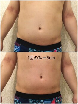 エステティックサロン リリース 東区筒井店(Release)/メンズメニューもあります。