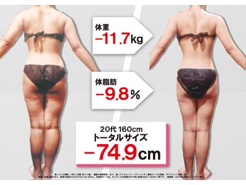 セントラヴィ 本厚木店/Before After【20代女性(4)】