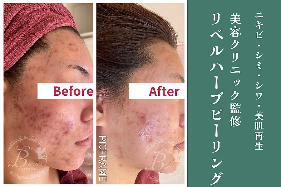 ビレナ(Birena)｜ホットペッパービューティー