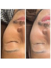 エターナル(Eternal)/男子☆ブライダルエステ