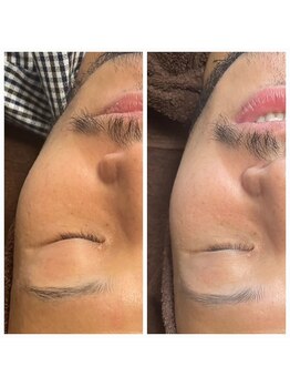 エターナル(Eternal)/男子☆ブライダルエステ