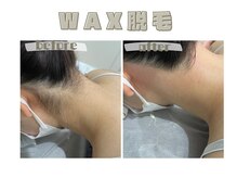 レヴィート(Revept)/【ワックス脱毛】