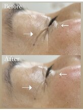 コーラル(CORAL)/60代*小顔リンパフェイシャル*