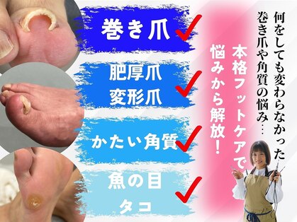 爪のいろはの写真