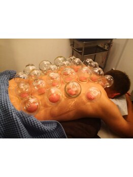 鍼灸施術を受けたい