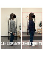 熊本カワル整体 JR上熊本駅院/腹横筋