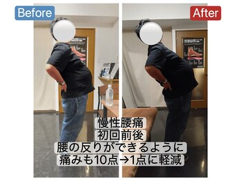 アンティオール 札幌店/30代男性　慢性腰痛