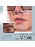【メンズ脱毛】　ヒゲ脱毛　都度払い30分　￥4500→￥3,000