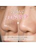 【つるん♪毛穴洗浄】毛穴すっきりソフトピーリング
