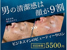 レオンザビューティー(REON the BEAUTY)