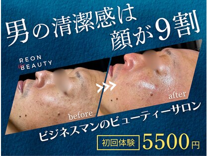 レオンザビューティー(REON the BEAUTY)の写真