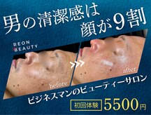 レオンザビューティー(REON the BEAUTY)