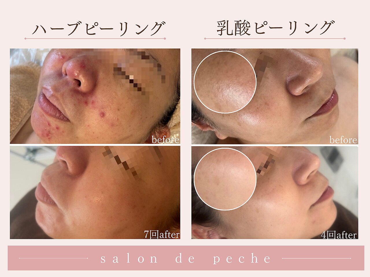 サロンドペシェ(salon de peche)｜ホットペッパービューティー