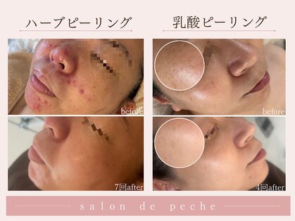 サロンドペシェ(salon de peche)の写真