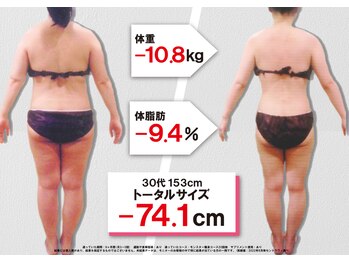 セントラヴィ 本厚木店/Before After【30代女性(1)】