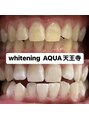 アクア 天王寺店(AQUA)&nbsp;セルフホワイトニング/大阪/天王寺/小顔/ホワイトニング/美白