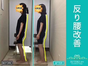 美骨矯正 ステキプロ(SUTEKI pro)/反り腰・ポッコリお腹・巻肩改善