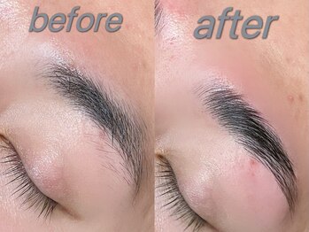 ティアマイレージ(TIA MILEAGE)/メンズハリウッドブロウリフト