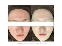 レーヴ 名古屋金山(Reve)の雰囲気（ヒト幹細胞＋ハーブで頑固なニキビケア/肌トラブルを根本改善！）