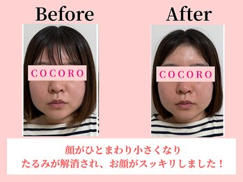 ココロ(COCORO)/美脳小顔矯正＆毛穴洗浄