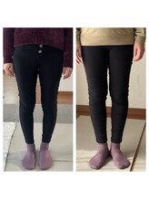 ララ(LARA)/Ｏ脚改善