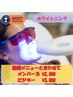 施術メニューと一緒にお得セルフホワイトニング¥2,000