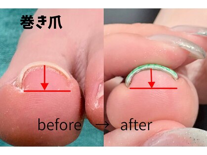 エン(en.)の写真