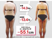 セントラヴィ 本厚木店/Before After【30代女性(2)】