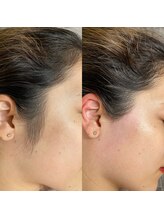 ラ フルール(La fleur)/