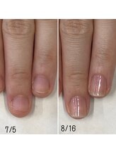 ネイルズ アヴァンティ(Nails Avanti)/自爪育成ネイルケア