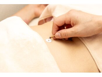 高麗鍼灸院/お腹のお灸