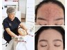 【人生最後のニキビケア】確実に効果を実感！感動の肌質改善¥14,850→¥9,900