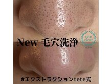 サロンド ケイティ(Salon de Katy)の雰囲気（今話題！の毛穴エクストラクション/毛穴洗浄/毛穴ケア/毛穴）