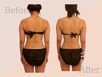 ファミーユ 名古屋店/【ダイエットケア】代謝促進ケア