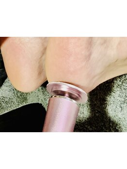 角質ケアができるサロン